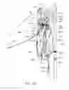 Fig. 13 - Deflectable endoscope and method of use