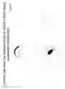 Fig. 07 - System for capsule endoscope having a diagnostic imaging means and method of using the same