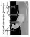 Fig. 19 - System for capsule endoscope having a diagnostic imaging means and method of using the same