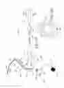 Fig. 17 - INDWELLING BLADDER CATHETER