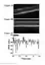 Fig. 04 - Device and method for optical retinography