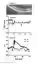 Fig. 06 - Device and method for optical retinography