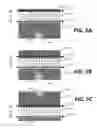 Fig. 06 - Selective illumination fundus imaging
