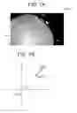 Fig. 09 - Ophthalmologic apparatus and method of controlling the same