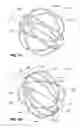 Fig. 02 - Variable density mapping catheter