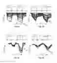 Fig. 07 - Dynamic optical tomographic imaging devices methods and systems