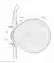 Fig. 01 - Glucose sensing contact lens