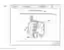 Fig. 01 - Determination and visualization of anatomical landmarks for intraluminal lesion assessment and treatment planning