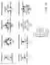 Fig. 13 - Systems and methods for detecting complex networks in MRI image data
