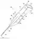 Fig. 01 - ULTRASOUND STYLET