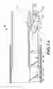Fig. 04 - Catheter assembly with offset device for tissue sampling