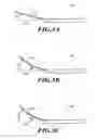 Fig. 06 - Catheter assembly with offset device for tissue sampling