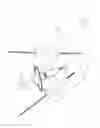 Fig. 17 - PNEUMOPERITONEUM DEVICE