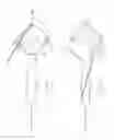 Fig. 21 - PNEUMOPERITONEUM DEVICE
