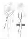 Fig. 22 - PNEUMOPERITONEUM DEVICE