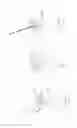 Fig. 24 - PNEUMOPERITONEUM DEVICE