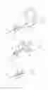 Fig. 25 - PNEUMOPERITONEUM DEVICE