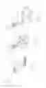 Fig. 28 - PNEUMOPERITONEUM DEVICE