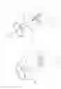 Fig. 35 - PNEUMOPERITONEUM DEVICE