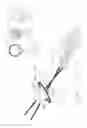 Fig. 42 - PNEUMOPERITONEUM DEVICE
