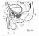 Fig. 05 - Devices, systems and methods for treating benign prostatic hyperplasia and other conditions