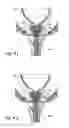 Fig. 12 - Devices, systems and methods for treating benign prostatic hyperplasia and other conditions