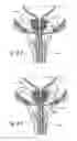 Fig. 13 - Devices, systems and methods for treating benign prostatic hyperplasia and other conditions