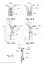 Fig. 27 - Devices, systems and methods for treating benign prostatic hyperplasia and other conditions