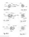 Fig. 32 - Devices, systems and methods for treating benign prostatic hyperplasia and other conditions