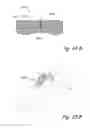 Fig. 33 - Devices, systems and methods for treating benign prostatic hyperplasia and other conditions
