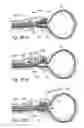 Fig. 44 - Devices, systems and methods for treating benign prostatic hyperplasia and other conditions