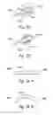 Fig. 49 - Devices, systems and methods for treating benign prostatic hyperplasia and other conditions
