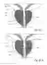 Fig. 53 - Devices, systems and methods for treating benign prostatic hyperplasia and other conditions