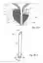 Fig. 58 - Devices, systems and methods for treating benign prostatic hyperplasia and other conditions