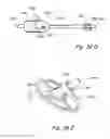 Fig. 60 - Devices, systems and methods for treating benign prostatic hyperplasia and other conditions