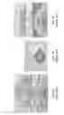 Fig. 02 - Minimally-invasive tissue suturing device