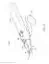 Fig. 14 - Offset jaw suturing device, system, and methods