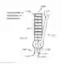 Fig. 01 - Bone staple insertion tool and related method