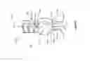 Fig. 04 - Bone staple insertion tool and related method
