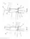 Fig. 05 - Bone staple insertion tool and related method