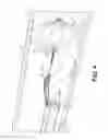 Fig. 05 - Tissue retraction devices and related methods of use