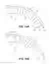 Fig. 14 - Tissue retraction devices and related methods of use
