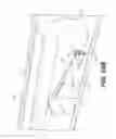Fig. 24 - Tissue retraction devices and related methods of use