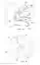 Fig. 11 - Treatment method for joining biological organs