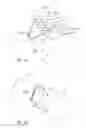 Fig. 21 - Treatment method for joining biological organs
