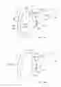 Fig. 27 - Treatment method for joining biological organs