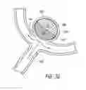 Fig. 16 - Occlusive devices