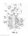 Fig. 04 - SMALL FRAGMENT RETRIEVAL DEVICE