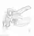 Fig. 03 - Surgical apparatus with jaw force limiter