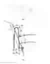 Fig. 02 - Dissection and ligation cartridge